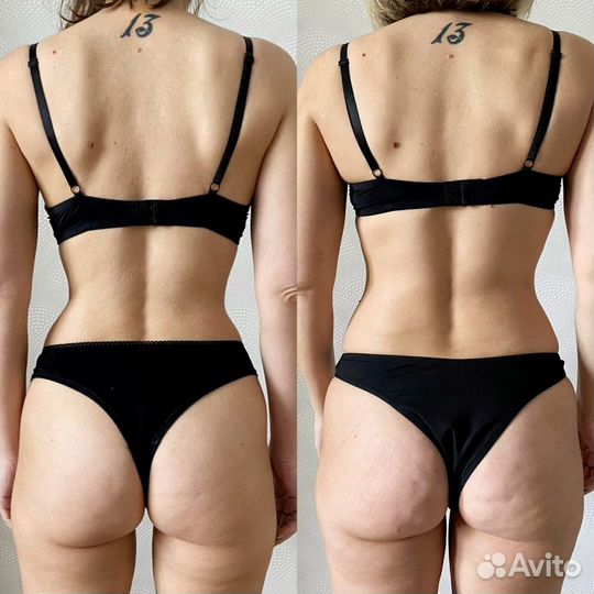 Аппаратный массаж, коррекция тела