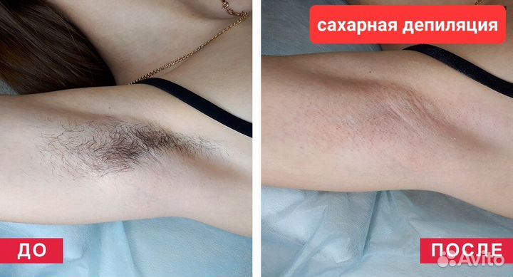 Шугаринг/ депиляция