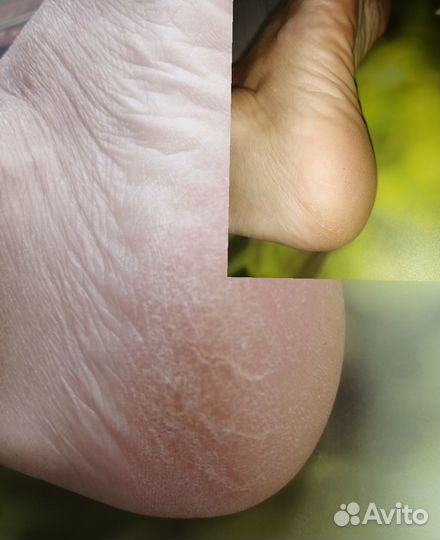 Маникюр /педикюр