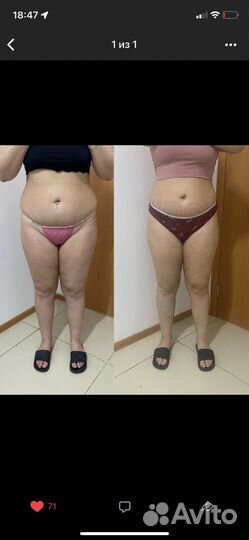 Антицеллюлитный массаж