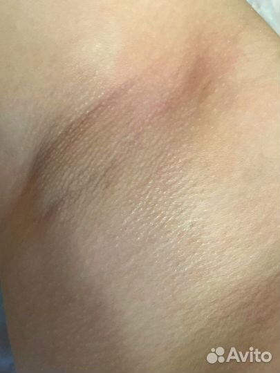 Шугаринг: бёдра