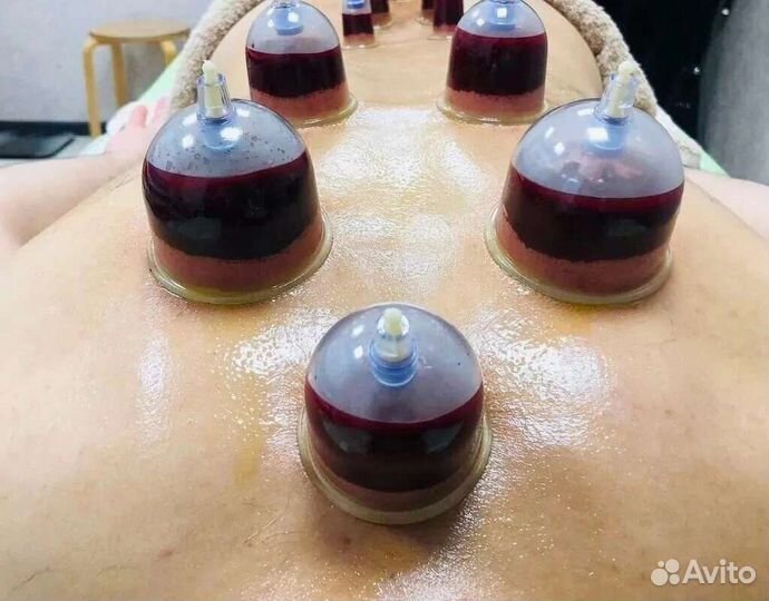 Хиджама. Выезд на дом