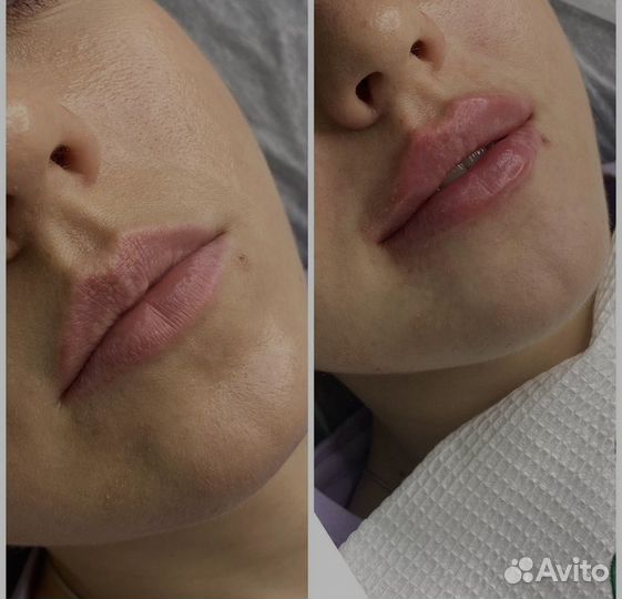 Врач косметолог