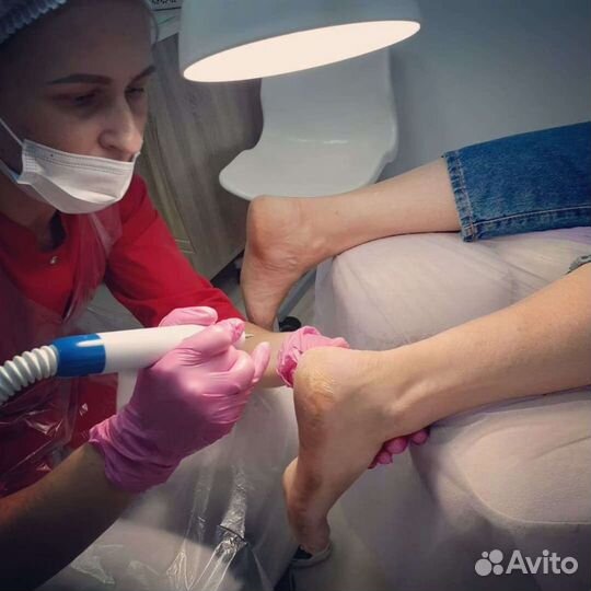 Педикюр(подолог)
