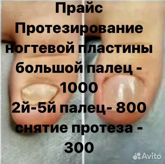 Подолог педикюр