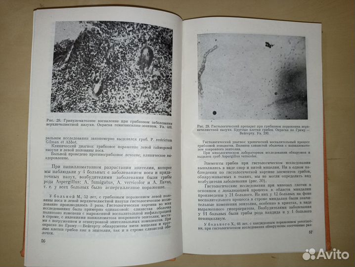 Микозы верхних дыхательных путей. Дайняк. 1979