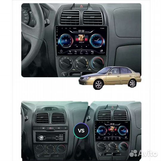 Магнитола 9