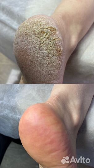 Услуги подолога