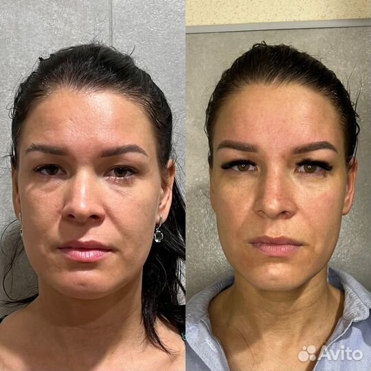 Глубокотканный массаж лица