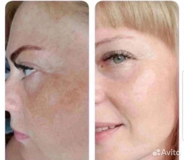 Сыворотка для идеального тона лица