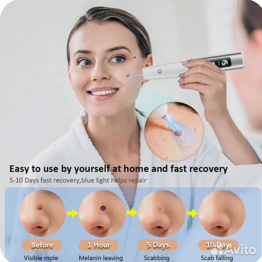 Косметический аппарат для лица, плазменая ручка