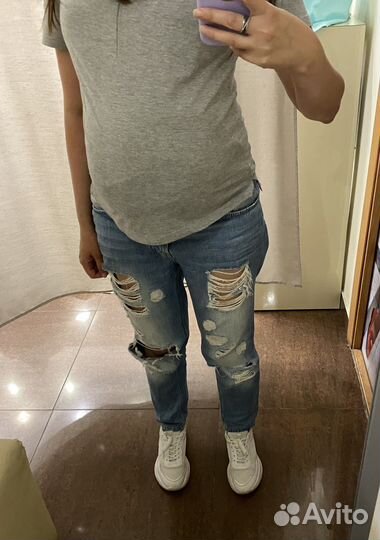 Накладной живот