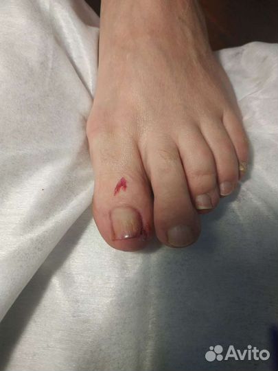 Гигиенический и эстетический педикюр (выезд на дом