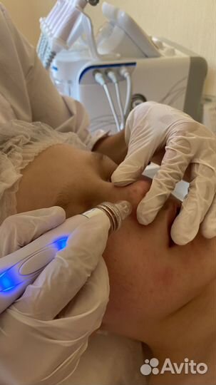 Гидропилинг