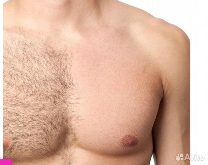 Мужская депиляция