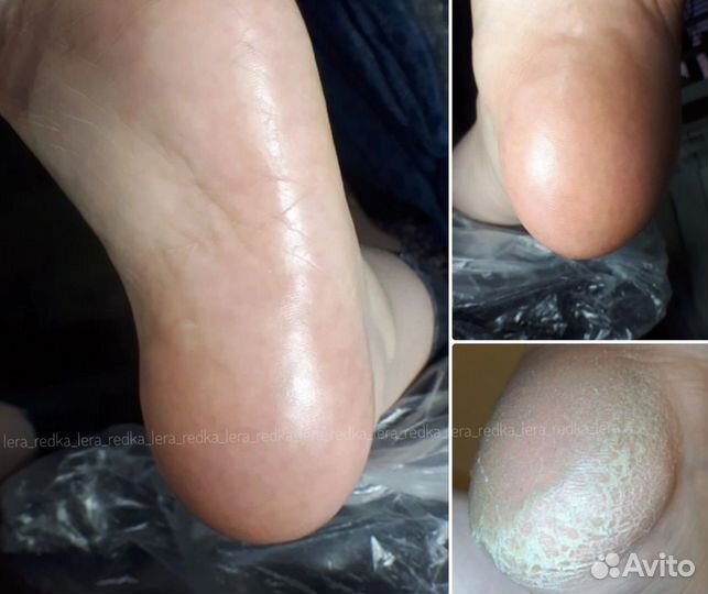 Педикюр Наращивание SMART, Маникюр Укрепление Гель