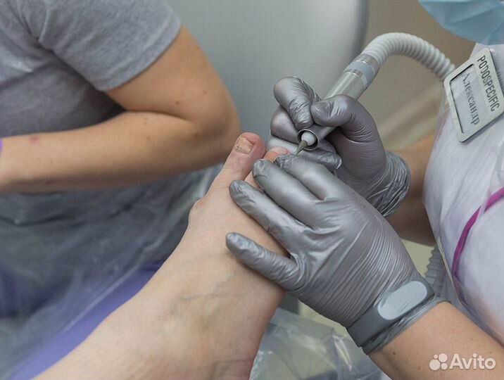 Медицинский (лечебный) педикюр - Подолог