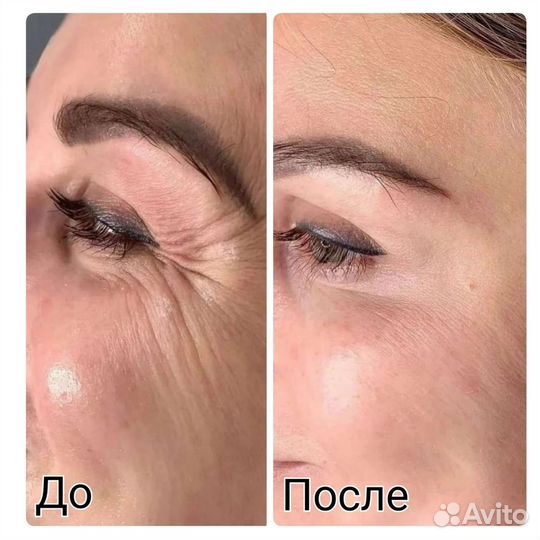 Услуги косметолога