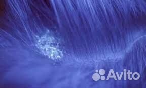 Лампа Вуда для диагностики кожи