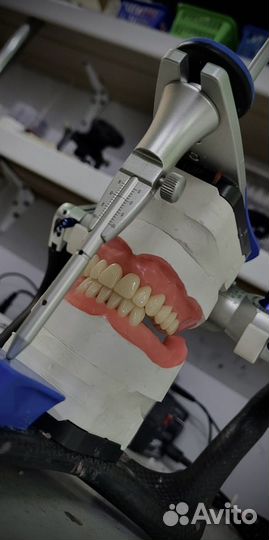 Зубные протезы