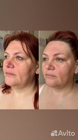 Массаж лица и тела