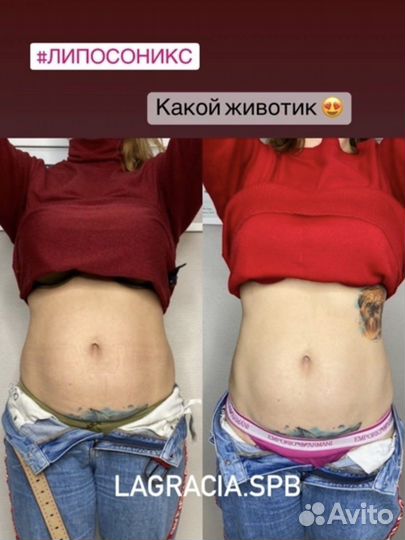 Липосоникс