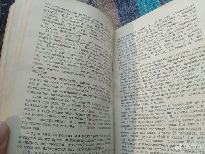 Книга сельской акушерки Николаев А. П. Медгиз 1950