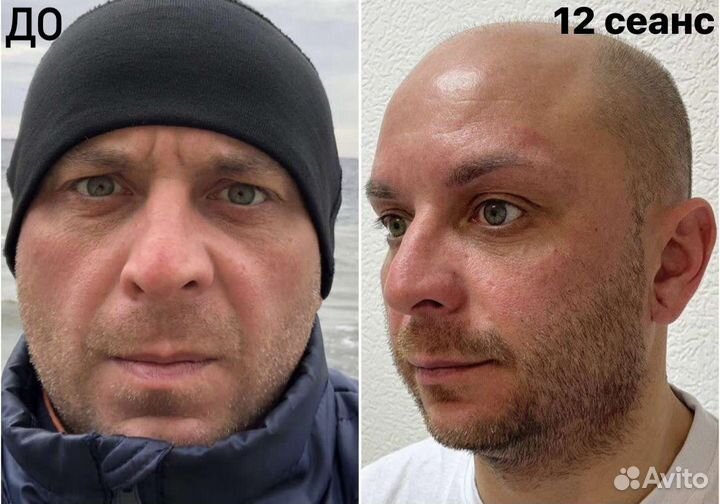 Ручной массаж лица и тела