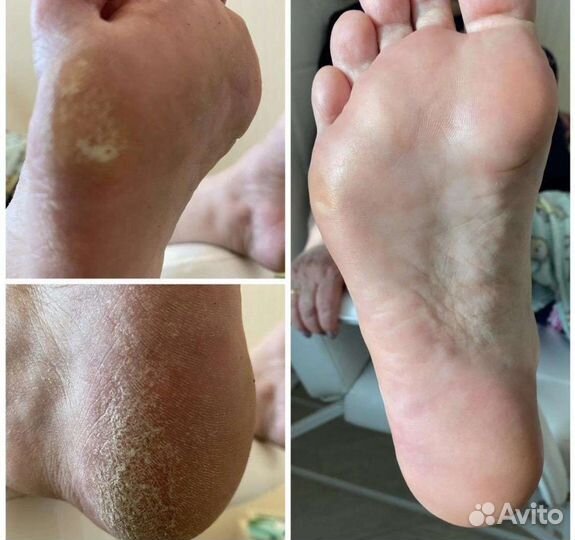 Маникюр с покрытием гель-лаком