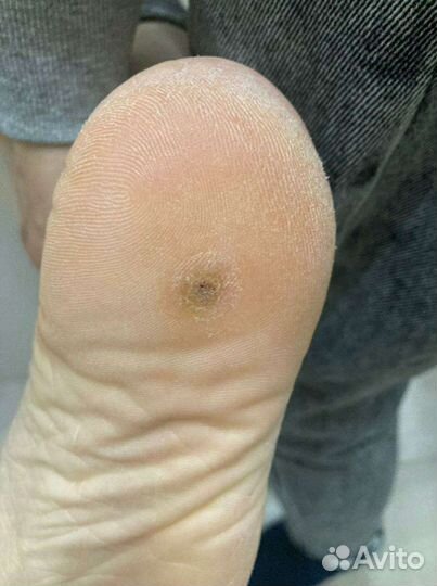 Гигиенический и эстетический педикюр (выезд на дом