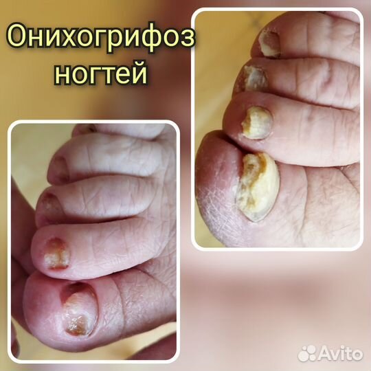 Педикюр-подолог, маникюр, депиляция, брови