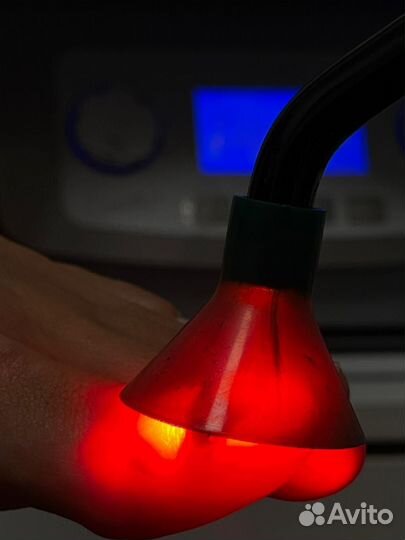 Подолог. Вросший ноготь. Мозоли. Бородавки. Грибок