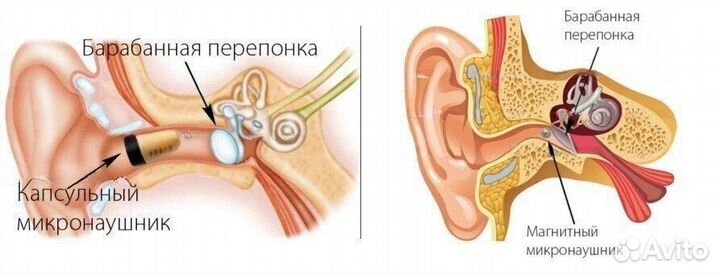 Микронаушник аренда