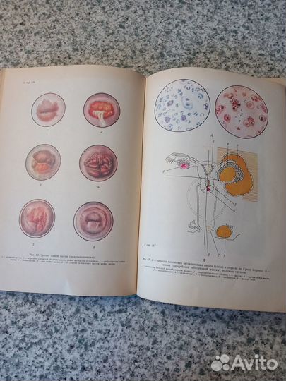 Гинекология