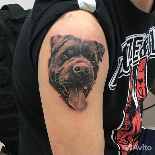 Удаление татуировок