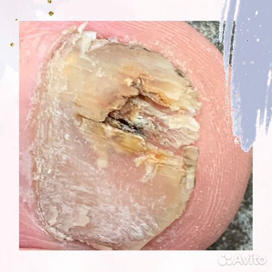 Маникюр, Педикюр, подолог