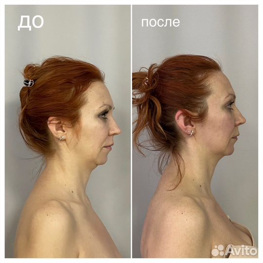 Остеопат/Массаж/Фасция/Коррекция тела/ бмс массаж