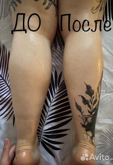 Лимфодренажный, антицеллюлитный массаж, классика