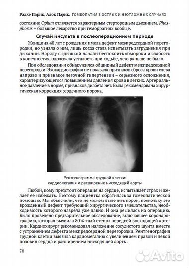 Гомеопатия в острых и неотложных случаях, Парик Р