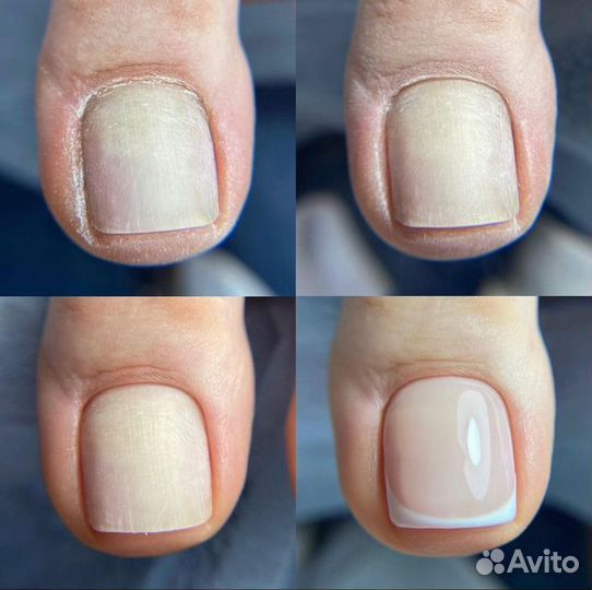 Педикюр гигиена и эстетика, без подологии