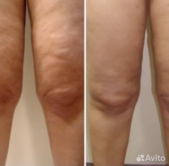 Массаж и коррекция фигуры