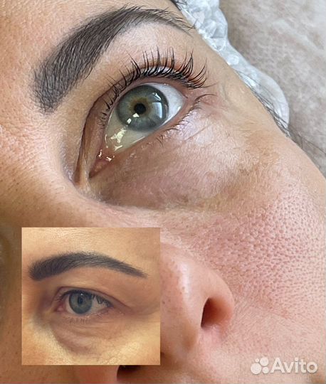 Ламинирование и ботокс ресниц