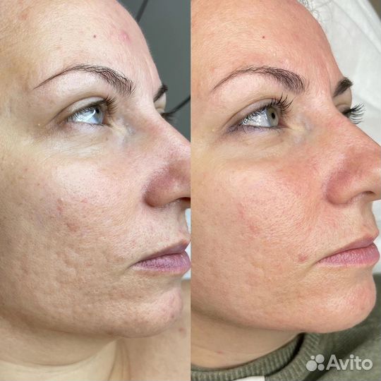 Требуются модели