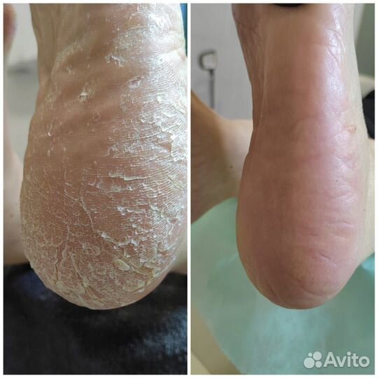 Мастер педикюра Подолог