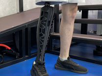 Бионические протезы ног за счет государства