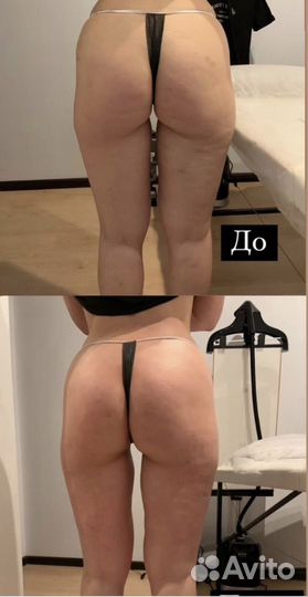 Профессиональный массаж тела