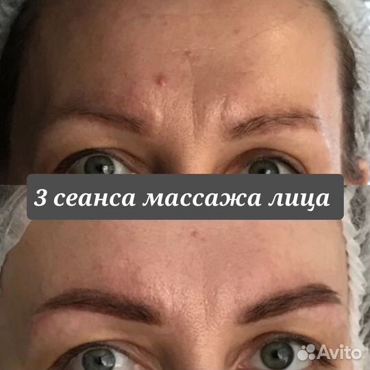 Массаж лица