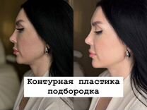 Модель контурная пластика лица (профиль Джоли, угл