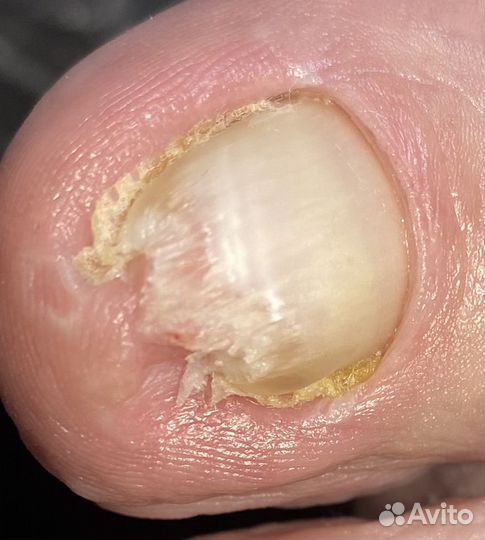 Модель на маникюр /педикюр