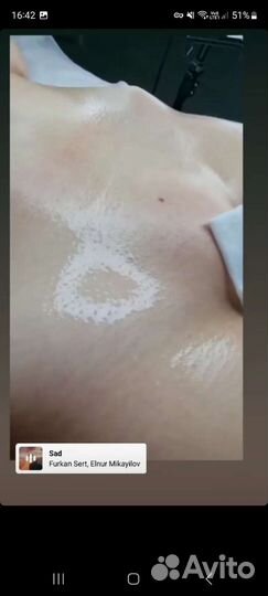 Эпиляция воском и шугаринг